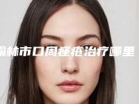 榆林市口周痤疮治疗哪里整形医院好(神木熙美御华施医疗美容诊所靠谱的选购指南)