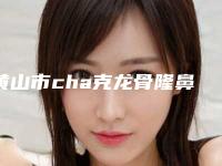 黄山市cha克龙骨隆鼻医院排名榜正规名单推荐-黄山莫凡医疗美容门诊部口碑top人气汇总